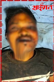 Jalgaon: संशयावरून बेदम मारहाण; उपचारादरम्यान मृत्यू, पाच जण ताब्यात Jalgaon: Brutally beaten on suspicion; died during treatment, five people detained