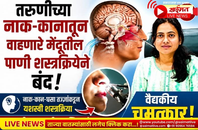 जळगावात वैद्यकीय चमत्कार! तरुणीच्या नाक-कानातून वाहणारे मेंदूतील पाणी शस्त्रक्रियेने केले बंद